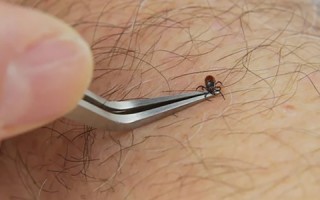 Bug Bite Thing® Tick Remover